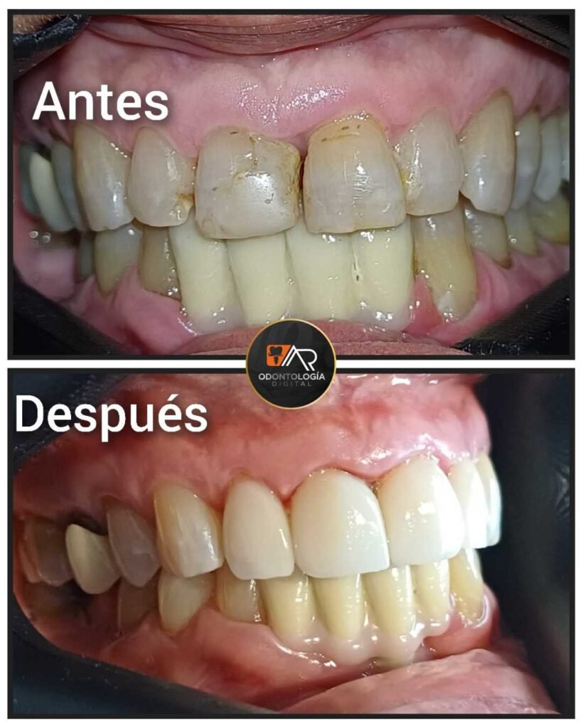 antes y después